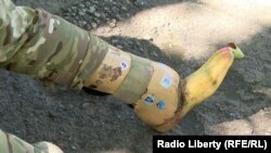 Протез «Молота»