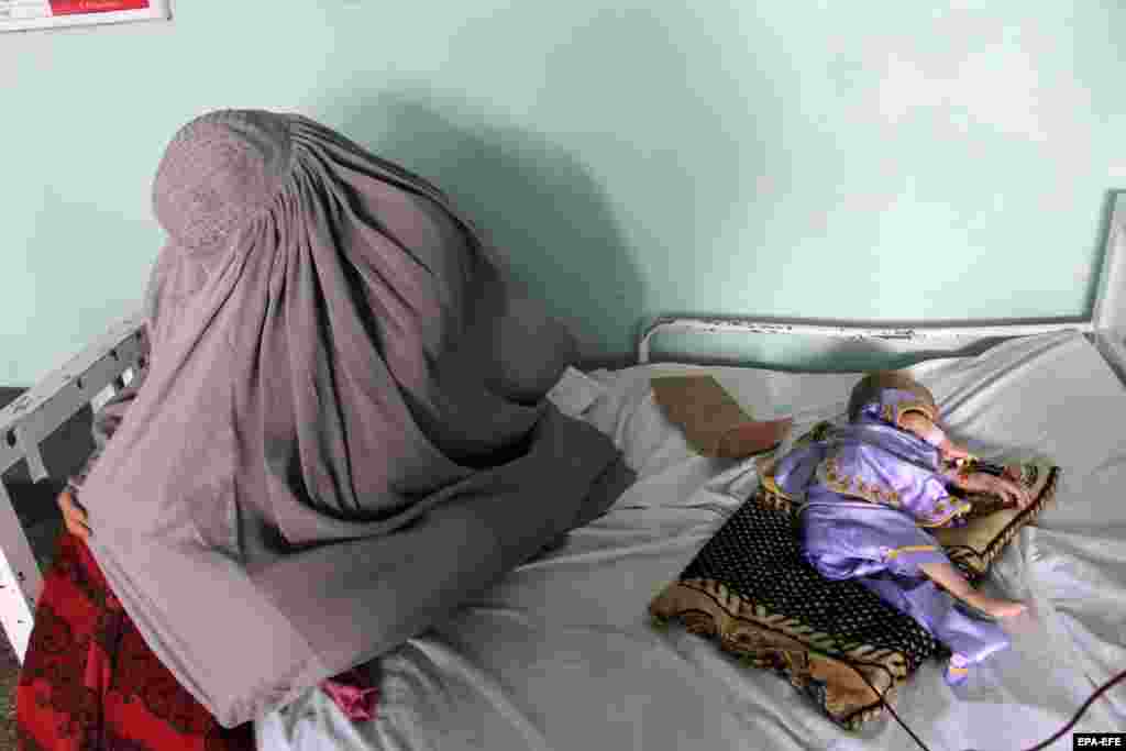 Afganistanka sjedi pored djeteta koje pati od pothranjenosti i drugih bolesti dok se liječi u bolnici Mirwais u Kandaharu.