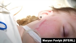 Дарина під час процедури лікування опіків