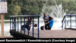 Потерпіла 16-річна біженка потрапила до лікарні із зламаною щелепою