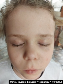 Ангеліна після процедури