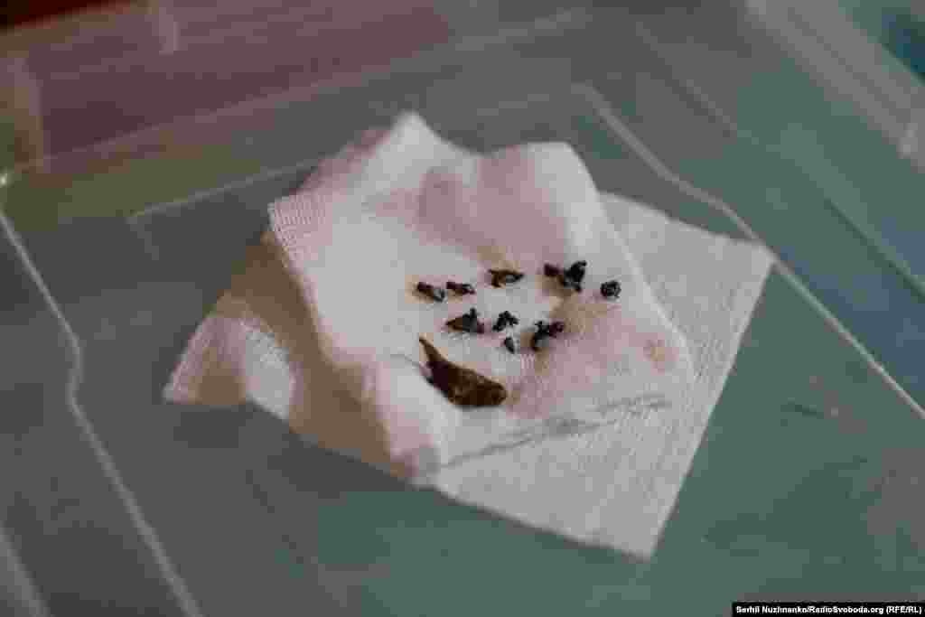 Осколки снарядов, извлеченные из тела раненого в медицинском учреждении под Авдеевкой, ​​март 2024 года