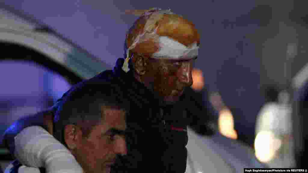 A hegyi-karabahi Sztepanakert közelében lévő üzemanyagraktári robbanásban megsérült férfit segítik ki a mentőautóból, amikor megérkezik egy jereváni égési sérülteket kezelő központba. A szakadár régió ombudsmanja, Gegam Sztepanján elmondta a Szabad Európának, hogy hatvannyolcan vesztették életüket a robbanásban, amely akkor történt, amikor az Örményországba menekülő emberek sorban álltak, hogy megtankolják autójukat. A robbanás okát nem sikerült megállapítani