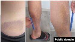 №8 түзөтүү колониясында сабалган делген адамдардын денеси. Сүрөт Кыйноолорду алдын алуу боюнча улуттук борбордуку.