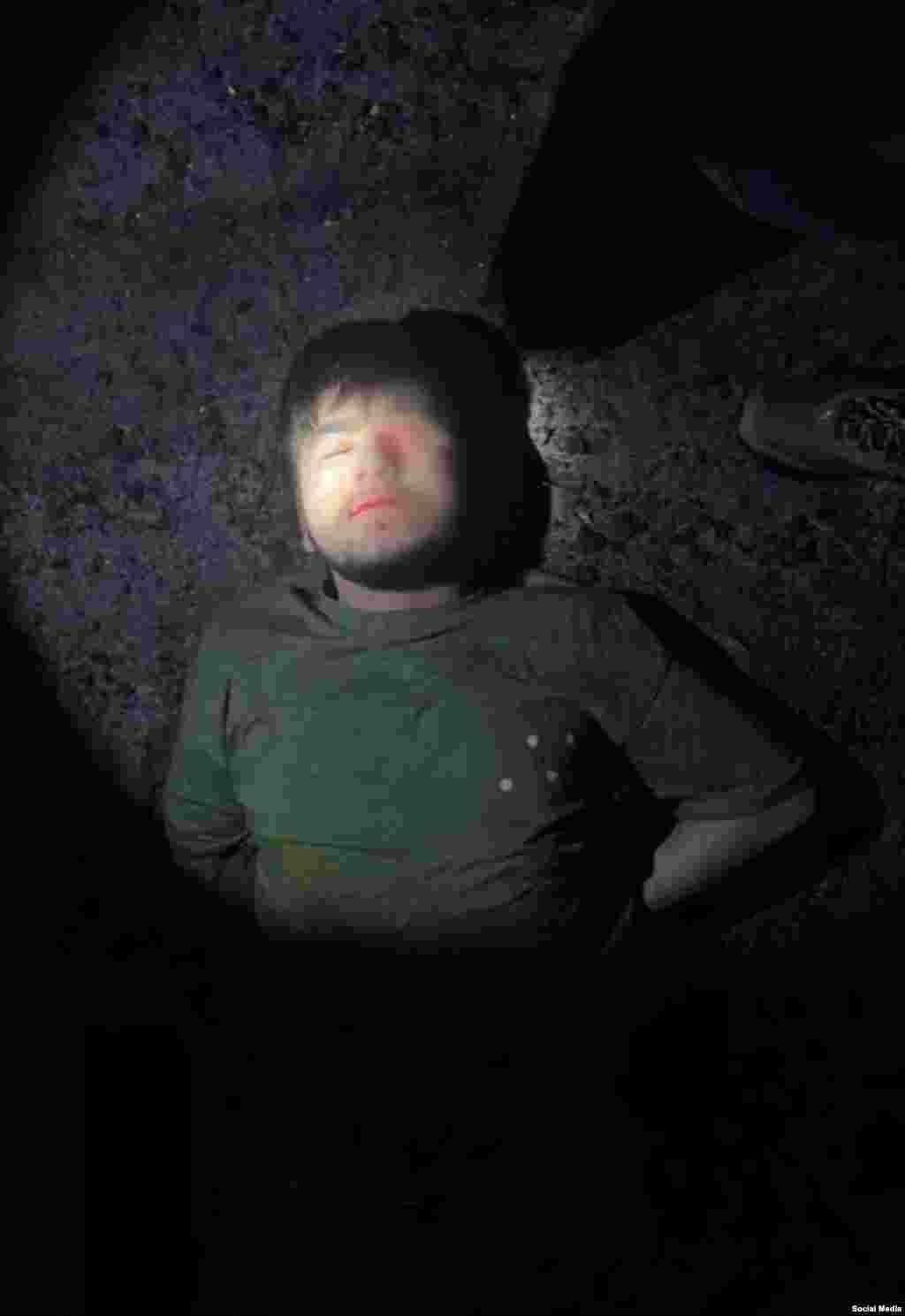 Muhammadsobir Faizov nakon hapšenja 23. marta s očigledno ozbiljnom povredom oka koju su ruski mediji zamaglili.