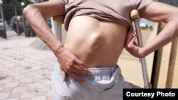 Бек Шеримбек уулу 2018-жылы Орусияда иштеп жүрүп, жумуштан кырсыкка кабылган. 30 жаштагы мигрантты курулушта кыш жүктөлгөн таңгак басып калып, омурткасы сынып кеткен. 