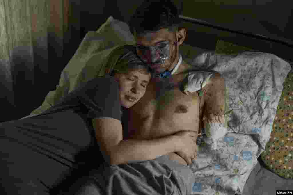 Alina grli svog muža Andrija u bolnici u Kijevu. Andrij je izviđački oficir 47. brigade ukrajinske vojske, kodnog imena Apostol, koji je teško ranjen u borbi sa ruskim trupama u regionu Zaporožja.