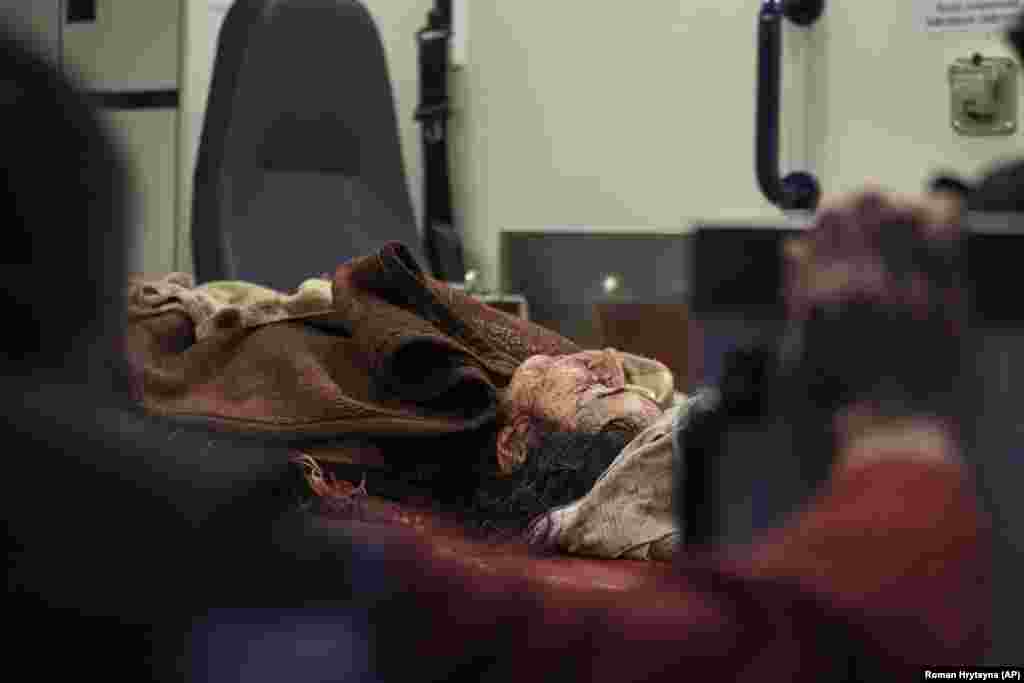 &nbsp;Žena leži u ambulantnim kolima nakon što je povrijeđena u napadu dronom na stan u Kijevu.&nbsp;