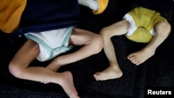 Csontsovány csecsemők – kiszáradás és éhezés miatt halnak meg az emberek a Gázai övezetben