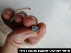 Один із осколків, який дістали з Олександра Шпилевського