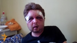 Політолог руху Femen каже, що його побили спецслужби