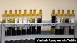 Пробирки с кровью для анализа на ВИЧ, гепатит и сифилис.