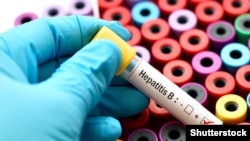 საილუსტრაციო ფოტო