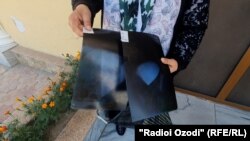 Рентгеновские снимки трам, полученных Элобат Огаликовой