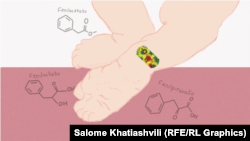 ფენილკეტონურია ეს არის ერთ-ერთი ყველაზე გავრცელებული მეტაბოლური დაავადება - გენეტიკურია. მისი აღმოჩენა და მართვა შესაძლებელია დაბადებისთანავე. 