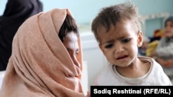 یکی از کودکان مبتلا به سوء تغذی در ولایت کندهار
