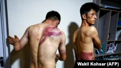 Ооганстандагы "Этилаатроз" басылмасынын кабарчылары талибдерде туткунда кезинде кыйноого алынышкан. Неамат Накди (солдо) жана Таки Даряби гезиттин Кабулдагы кеңсесинде. 8-сентябрь, 2021-жыл.