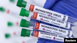 Маймыл чечегине шектелгендердин анализдерин текшерүү учуру. Иллюстрациялык сүрөт.