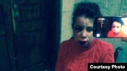 Тетяна Чорновол після жорстокого побиття