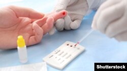 Testiranje na HIV, hepatitis B, C i sifilis (foto ilustracija)