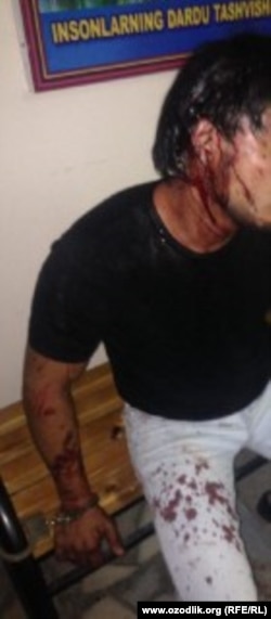 27-летний житель Ташкента Шахрух Джураев после избиения в отделении милиции.