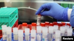 Laborator în care sunt făcute teste pentru depistarea Covid 19