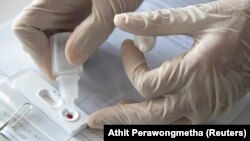 COVID-19 вирусун аныктоочу экспресс тест-системдин бир түрү. Таиланд. 2-апрель, 2020-жыл.