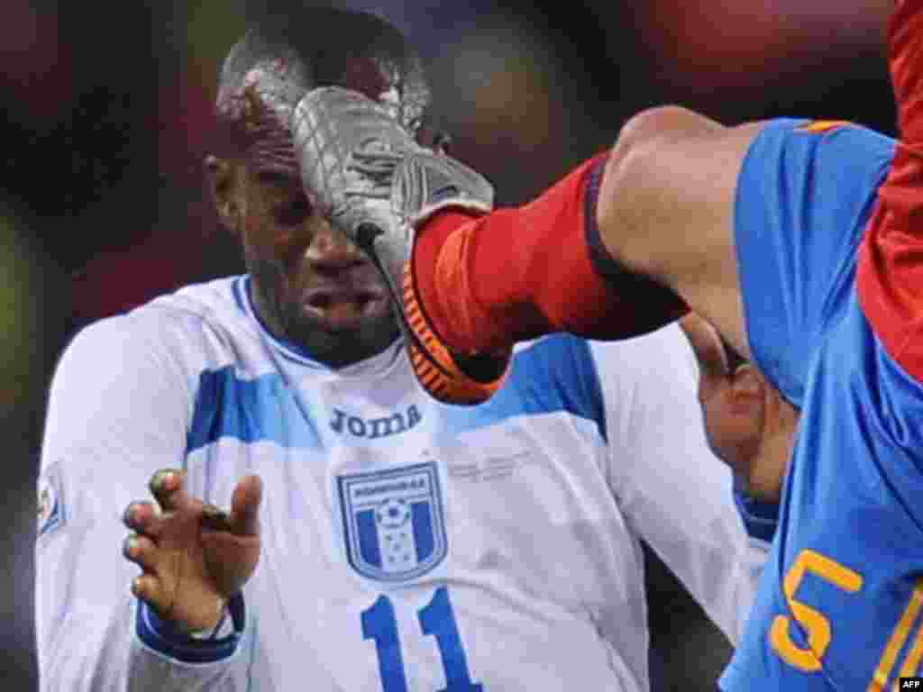 ესპანეთის ნაკრების მცველის, კარლოს პუიოლისა და ჰონდურასის გუნდის თავდამსხმელის, დავიდ სუაზოს შეჯახება - სამხრეთ აფრიკის სტადიონებზე გრძელდება მსოფლიო ჩემპიონატი ფეხბურთში. ფიფას თასისთვის ბრძოლა ძალას იკრებს. გამარჯვებული 11 ივლისს გამოვლინდება. 