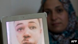 طارق ابوخضیر، پسرعموی نوجوان مقتول مورد ضرب و شتم قرار گرفته بود