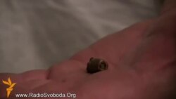 В людей стреляли из снайперских винтовок - хирург