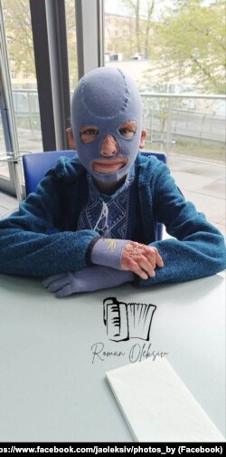 Roman Olexiv a purtat o mască de compresie pe cap și pe față timp de doi ani după atacul care l-a lăsat cu arsuri grave.