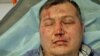 Russia - Kyrgyz taxi driver beaten by passengers - cover