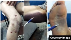 Кыйноого кабылды делген шектүүнүн сүрөттөрү.