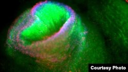 Cryo-Save, Европадагы сөңгөк клеткаларын сактоочу эң чоң банк киндик канынан сөңгөк клетасын бөлүп алып, узак мөөнөткө сактоого адистешкен. Фотосүрөт