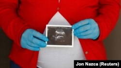 Trudnica u Španiji sa zaštitnim rukavicama, april 2020. 