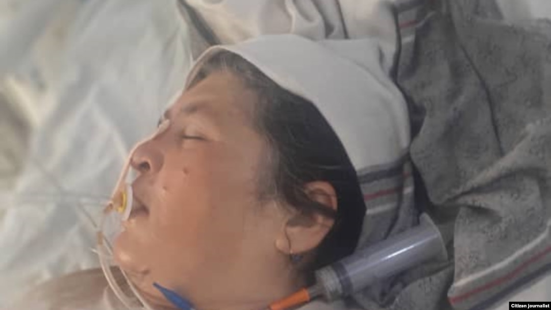 بستگان گلبیبی ادعا میکنند فرمانده پولیس با دریافت پول حمله کرده است.