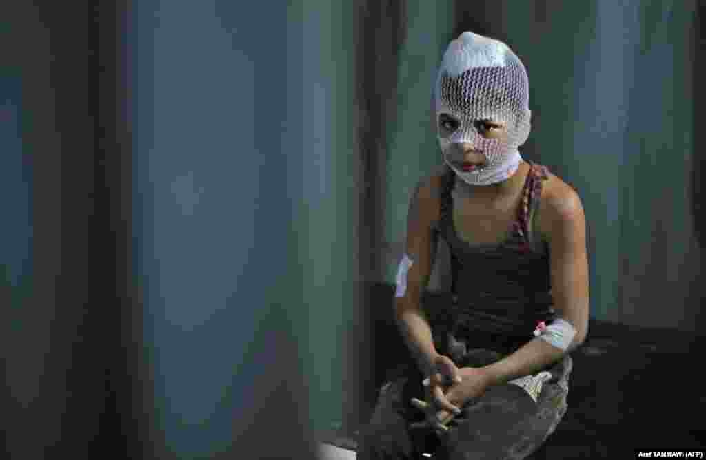 Сириянын түндүк-батышындагы Идлиб провинциясында Башар Асаддын армиясынын абадан урган соккуларынан кийин жараат алган сириялык жаш бала, Маарет-Мисрин шаарындагы ооруканалардын биринде отурат.&nbsp;