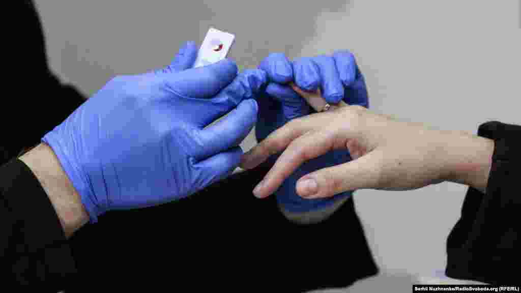 Експрес-тест на ВІЛ