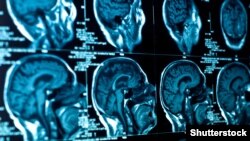 Иллюстративное фото 