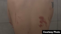 Тело Светы после нападения