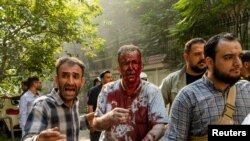 Ин мард дар ҳамлаи Исроил ба Эрон захмӣ шудааст