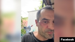 ვანიკო თარხნიშვილი თავდასხმას უკავშირებს „ოლე, ოლას“ სიმღერას.