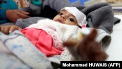 کودک یمنی مبتلا به وبا در صنعا