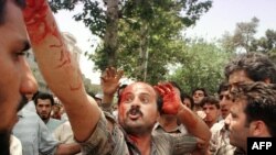 یکی از زخمی‌شدگان وقایع ۱۸ تیر ۱۳۷۸