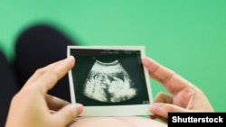 Иллюстрациялык сүрөт.