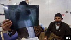 د خیبر پښتونخوا چارواکي وايي، د نري رنځ ویړیا درملنه کوي. 