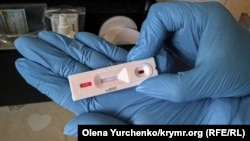 Un test rapid de coronavirus, cu rezultat negativ, 8 aprilie 2020