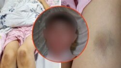 Узбекистанка умерла в больнице после семейного насилия – супруг избивал ее на глазах у детей