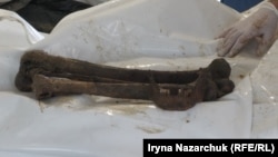 Більшість останків репатрійованих Росією тіл у дуже поганому стані. Ось що залишилося від тіла бійця. Одеса, 8 вересня 2025 року 