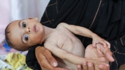 Obitelji u Gazi sve teže do hrane